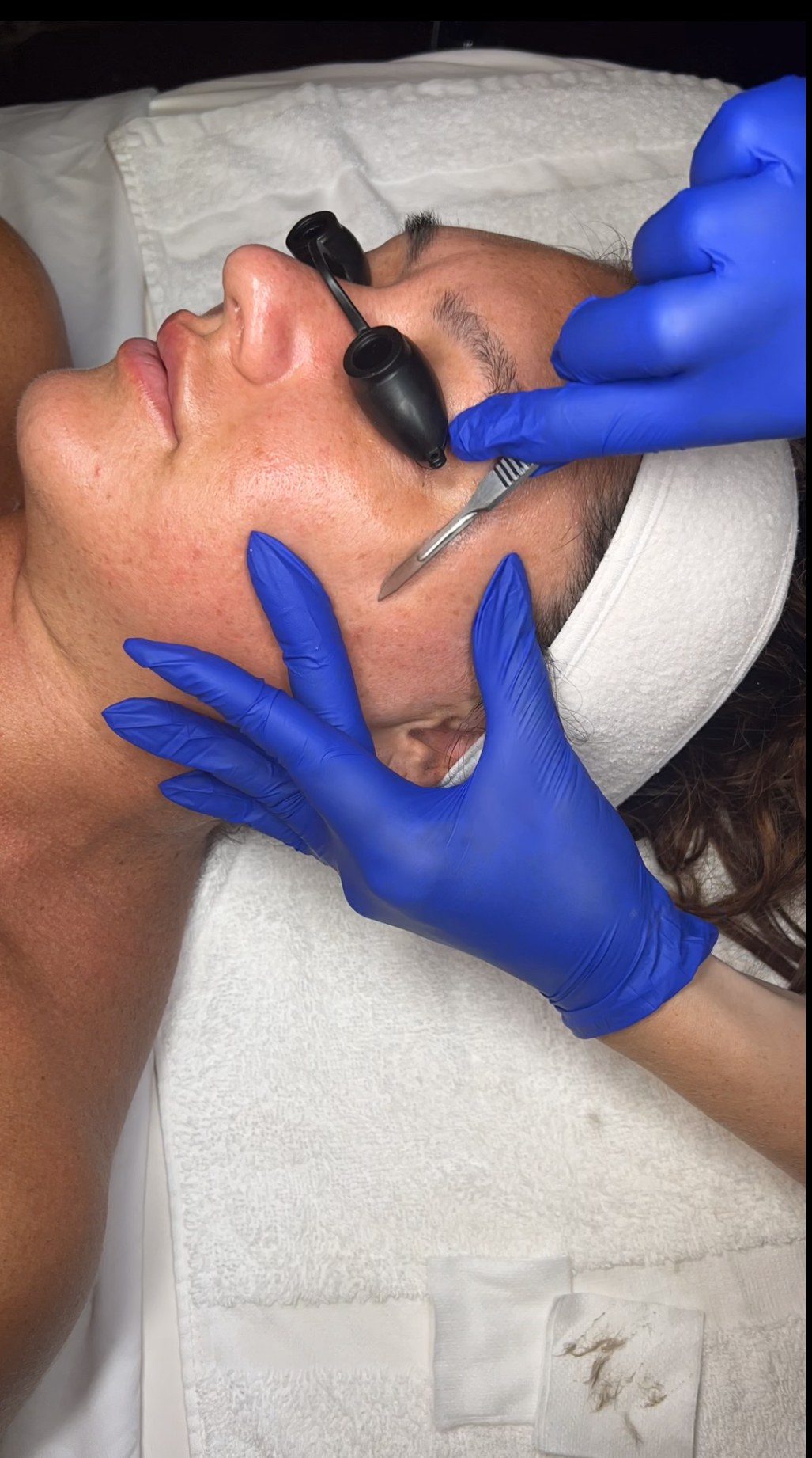 Dermaplaning vs Microdermabras, cover — The Bronze Lily, St. Petersburg, FL