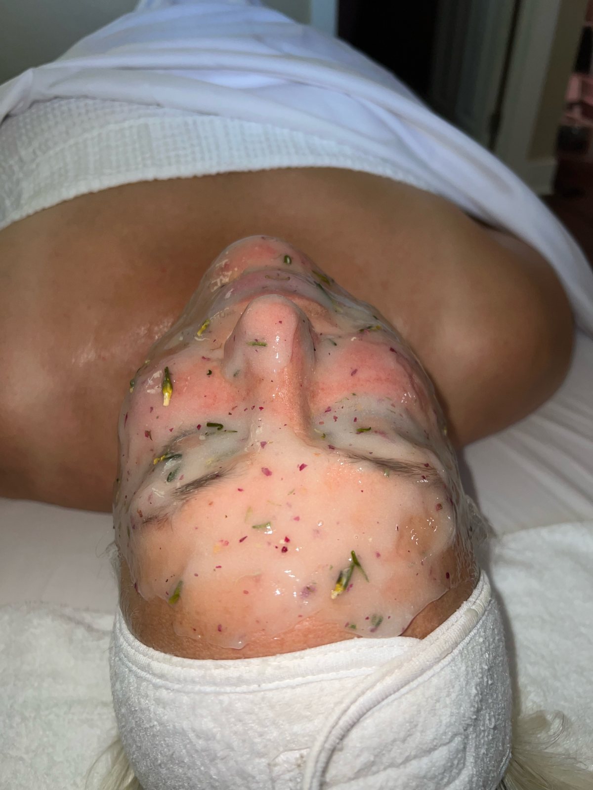 Clinical facial treatment — client work — The Bronze Lily, St. Petersburg, FL