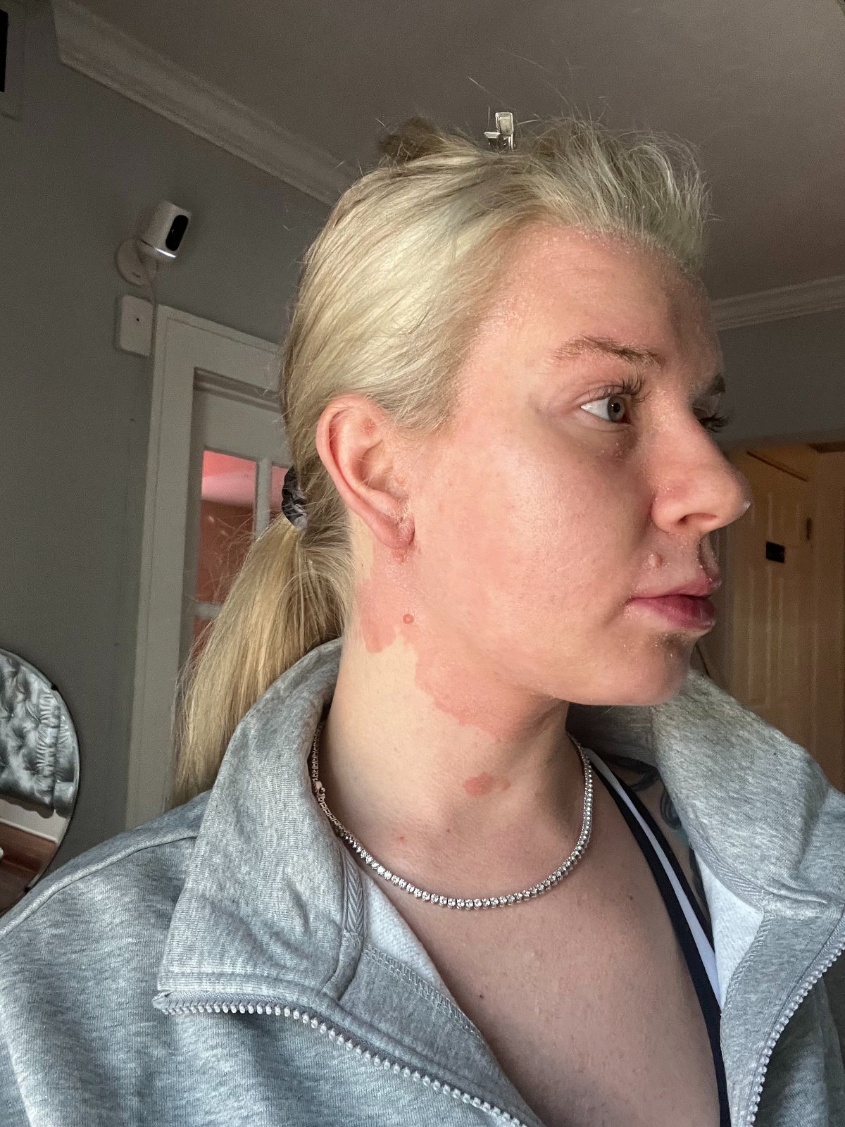 Healing, skin calming, turning the corner — The Bronze Lily, St. Petersburg, FL
