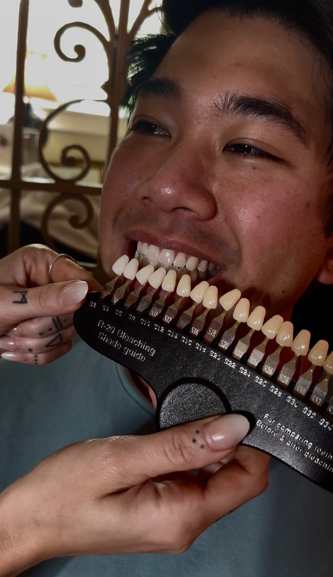 Teeth Whitening — The Bronze Lily, St. Petersburg, FL