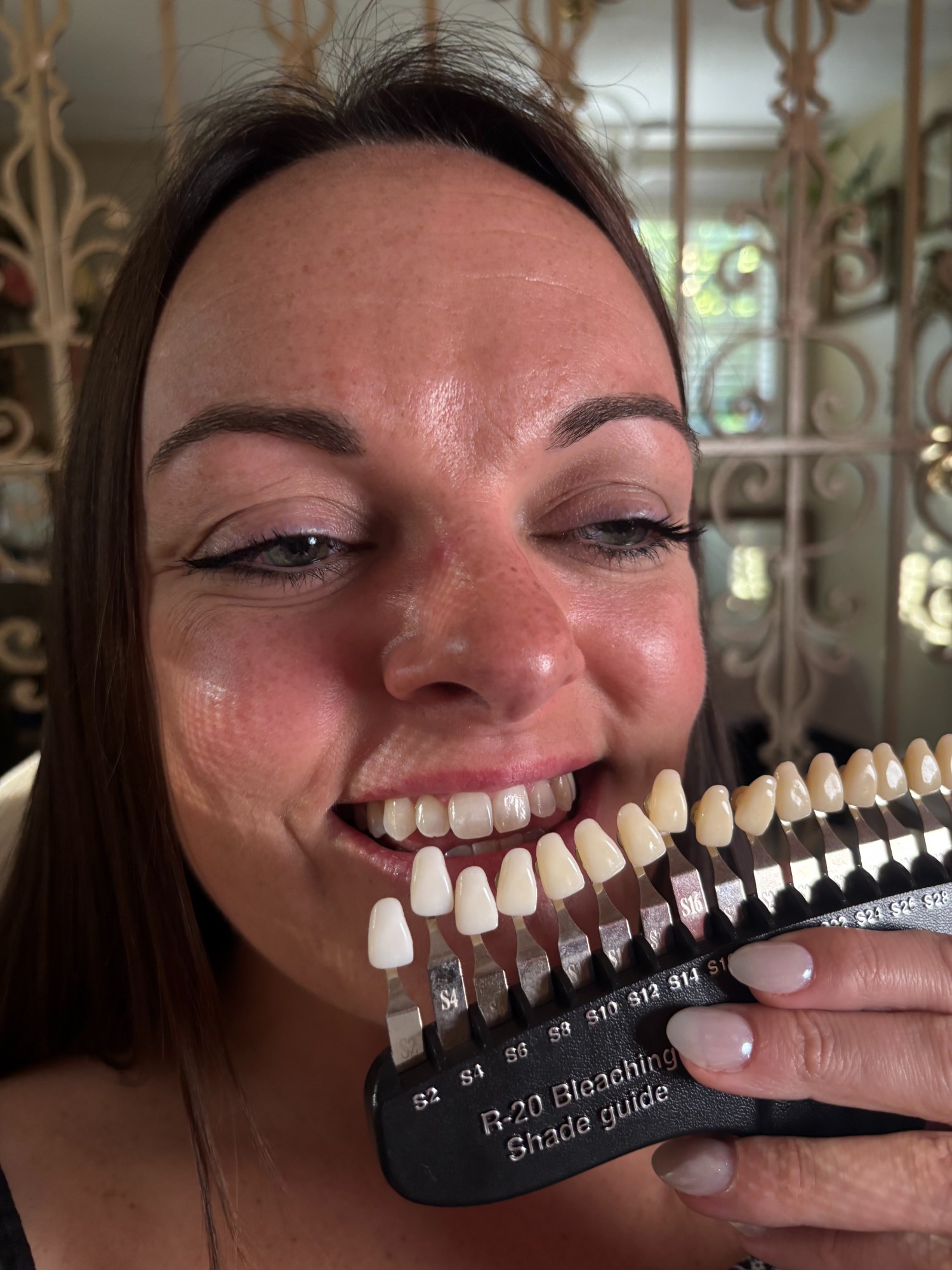 Teeth Whitening — The Bronze Lily, St. Petersburg FL
